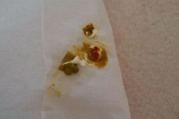 鹦鹉生病的症状，可能会出现嗜睡、腹泻等症状