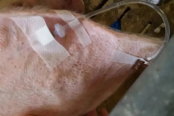 母猪几天不拉粪便怎么办，应帮助母猪赶紧排便